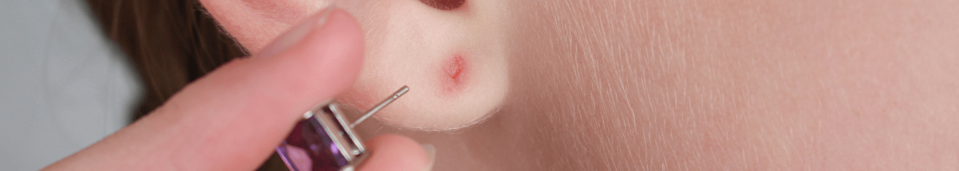 Wie schnell wächst ein Piercing-Kanal eigentlich wieder zu?